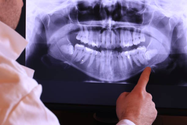 Best Emergency Treatment for Jaw Pain or Injury in Clarkson, KY